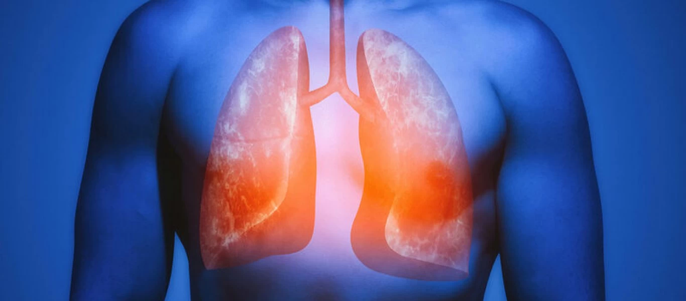 Αυτές είναι οι επτά τροφές που καθαρίζουν τους πνεύμονες